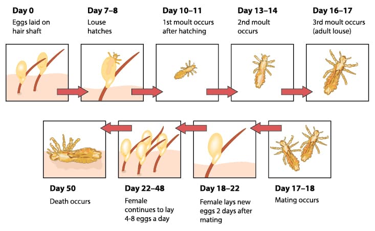How Do You Get Lice In The First Place